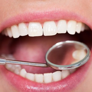 Close-up of a healthy smile