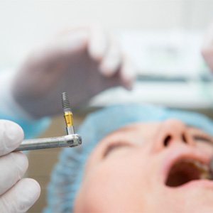 Dental implant surgery  