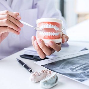 dentist discussing the cost of dental implants