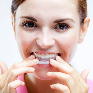 woman with whitening tray in