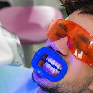 man with office whitening tray in