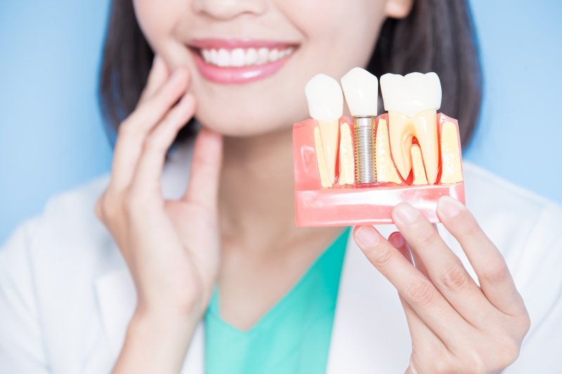 A dentist holding a model of dental implants