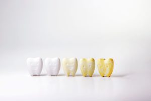 5 models of teeth in varying stages of discoloration and emoting accordingly on a white background